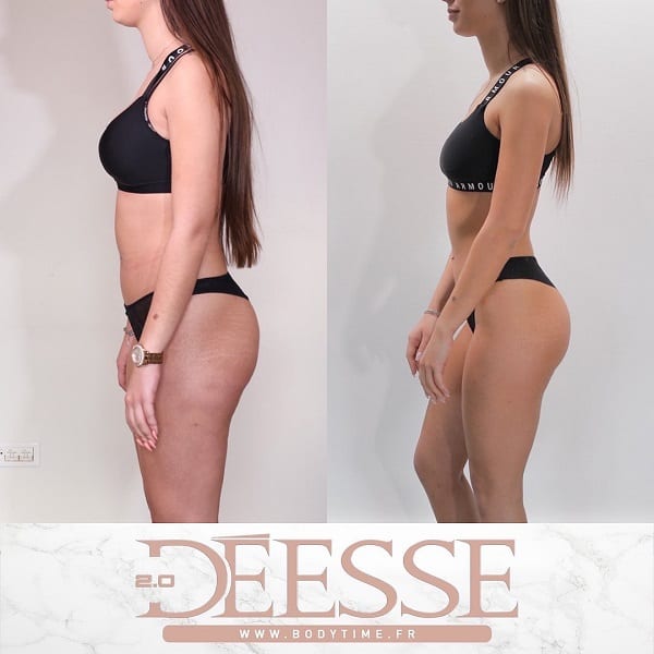 deesse avant apres